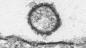 Das Virus aus der Mückenfalle