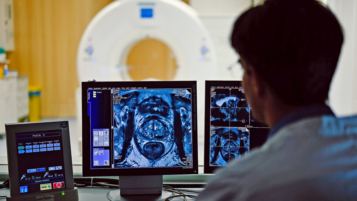 Fortgeschrittene Diagnostik: Im MRT-Kontrollraum des Deutschen Krebsforschungszentrums ist das Querschnittsbild einer Prostata zu sehen.