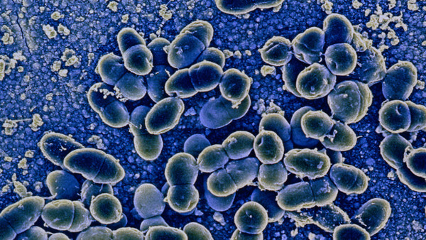 Streptokokken sind weit verbreitete Bakterien. In seltenen Fällen können sie sehr schwere Infektionen verursachen.