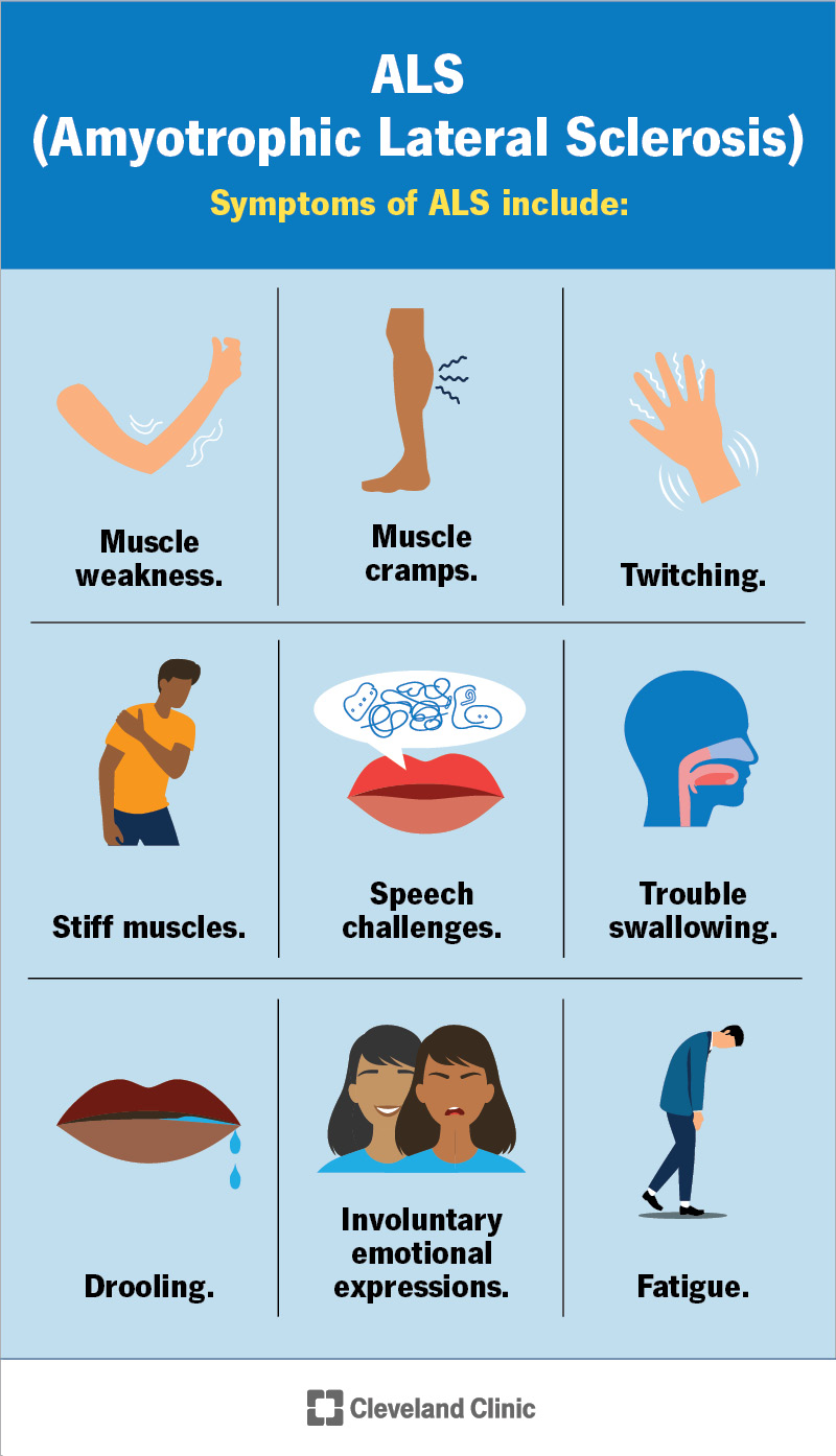Common symptoms of ALS caused by motor neuron damage include muscle weakness, tremors and speech challenges