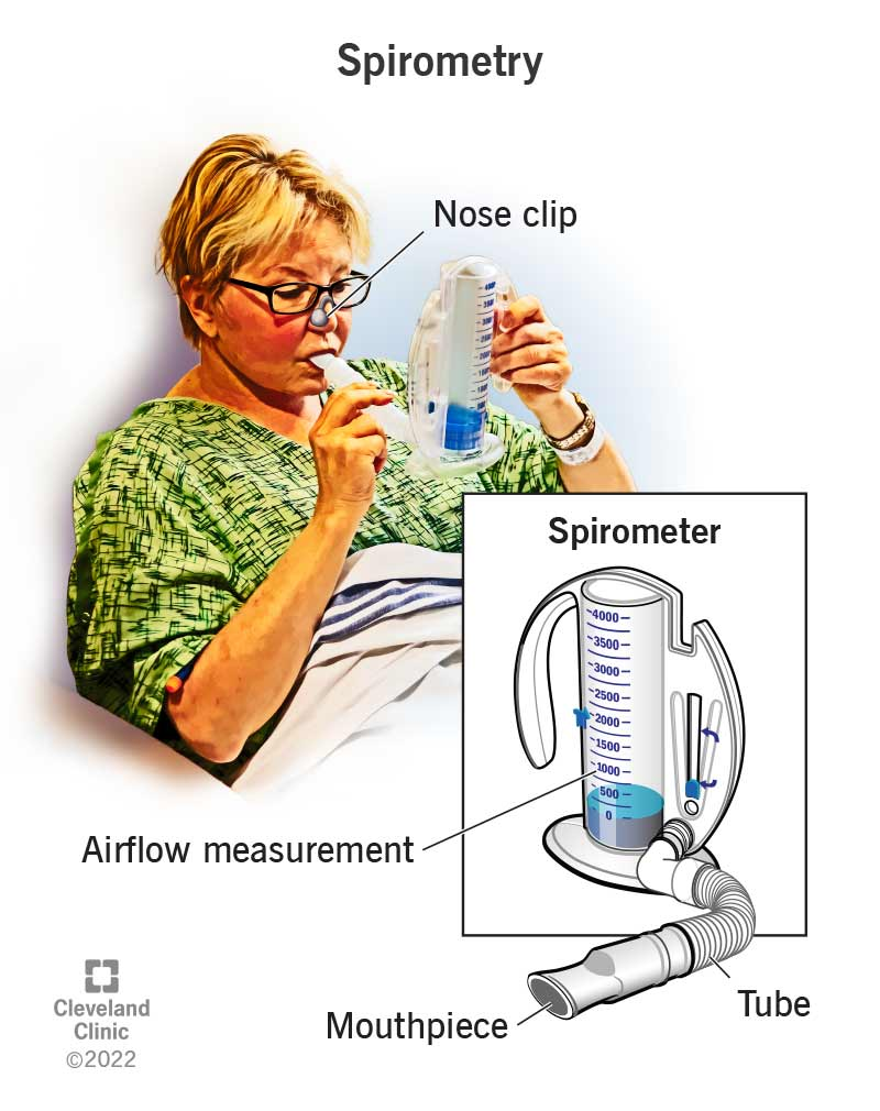 Spirometry is a type of pulmonary function testing that uses a spirometer to measure air flow and amount of air in your lungs