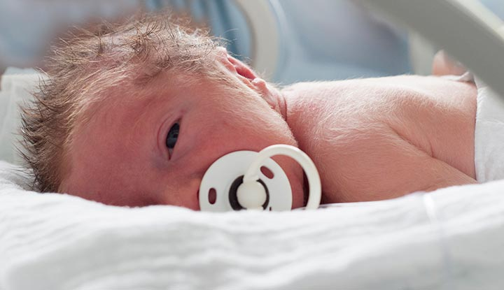 Lanugo hair covering the shoulders, back and face of a newborn baby.