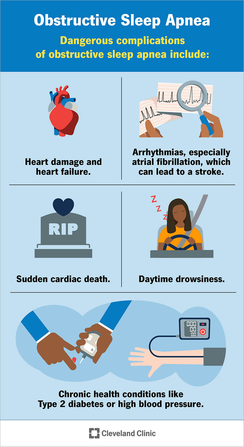 Obstructive sleep apnea can raise your risk of many health problems, especially developing heart failure or having a stroke.