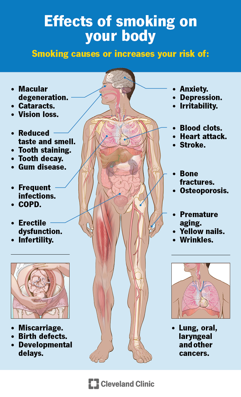 Effects of smoking on your body, including: skin, nails, eyes, nose, mouth, lungs, heart, blood vessels, brain, and bones.