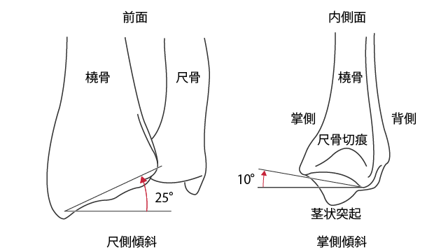 尺側傾斜と掌側傾斜