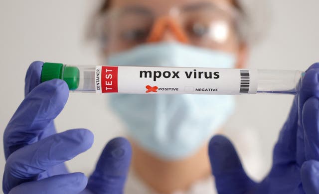 <p>Illustration shows test tubes with “Mpox virus positive” label</p>