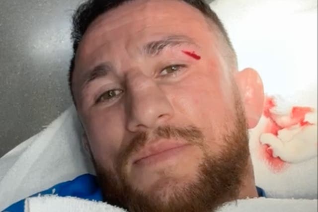 <p>UFC bantamweight Merab Dvalishvili, sharing footage of a cut being treated</p>