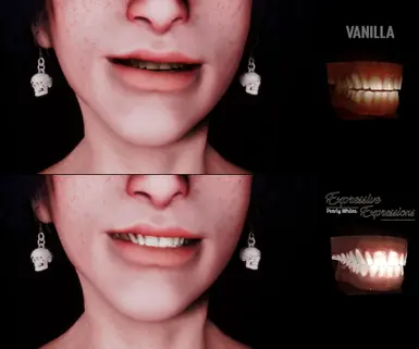 Teeth comparison