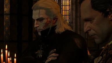 Optional Geralt face and body scarred