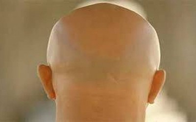 Bald men will not be able to turn the sun into energy