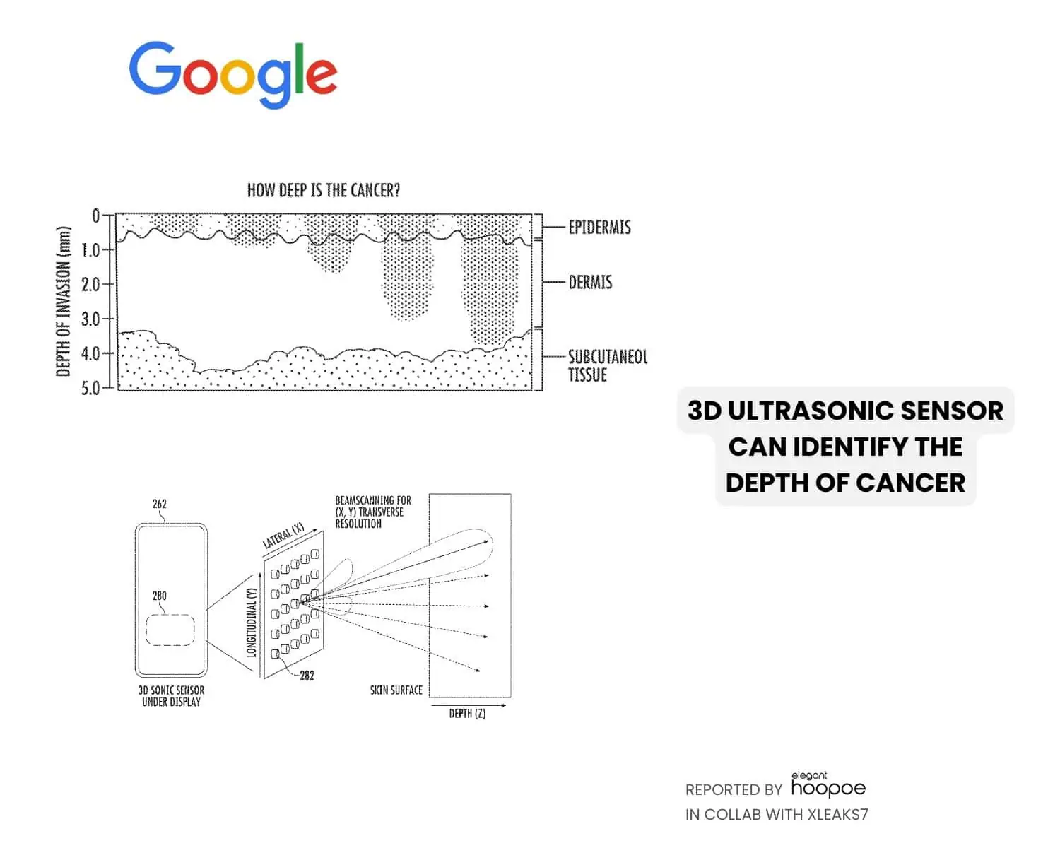 Google Pixel AI skin cancer patent 2
