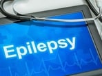 The lack of awareness about epilepsy and seizures is a startling reality that often goes unnoticed and while many people have a general understanding of what epilepsy is, there remains a significant gap in knowledge about the condition and its impact on individuals' lives. This International Epilepsy Day, it is crucial to recognise that epilepsy is not merely experiencing occasional seizures and can profoundly affect someone's physical, mental and emotional well-being. In an interview with Zarafshan Shiraz of HT Lifestyle, Dr Pankaj Agarwal, Senior Consultant Neurologist and Head of the Department of Neurology at Global Hospitals in Mumbai's Parel, shared, “This lack of awareness can lead to stigmatization and discrimination against those living with epilepsy, further complicating their everyday experiences.  An inadequate understanding of epilepsy can result in delayed or improper treatment for those affected by the condition. We aim to bust myths regarding epilepsy and seizures.” He dispelled the myths surrounding epilepsy and seizures - (Shutterstock)