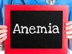 Anemia is a condition characterised by a deficiency in the number of red blood cells or a decrease in the amount of hemoglobin in the blood. In an interview with Zarafshan Shiraz of HT Lifestyle, Dr Abhijit Borse, Interventional Cardiologist at Asian Heart Institute in Mumbai, revealed that since the heart is responsible for the pumping and distribution of this blood, anemia can impact the heart in the following ways -(File Photo)