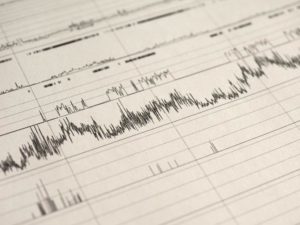 Sleep Study diagnostic